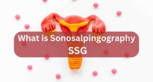 SSG full form in medical