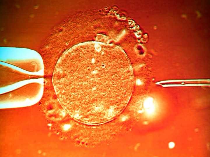 Difference Between IVF And Test Tube Baby